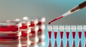 financialounge -  GAM Mirjam Heeb settore sanitario stock picking