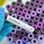 Coronavirus, ecco i titoli penalizzati che potrebbero tornare a salire