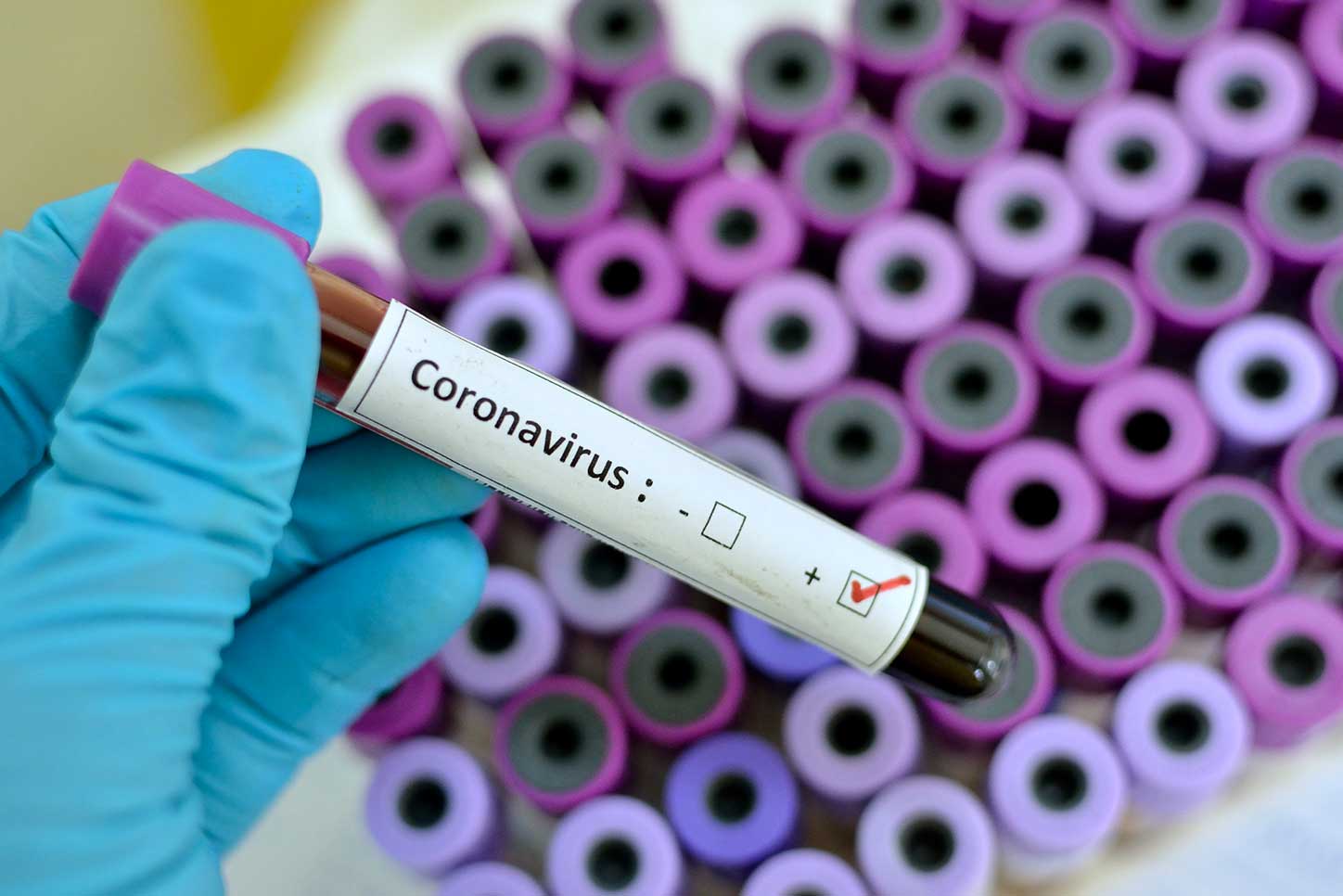 financialounge -  coronavirus GAM Tim Love