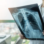 Chi ha avuto il Covid non paga gli esami per due anni: ecco perché