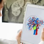 MedTech, a guidare gli investimenti record c’è l’intelligenza artificiale